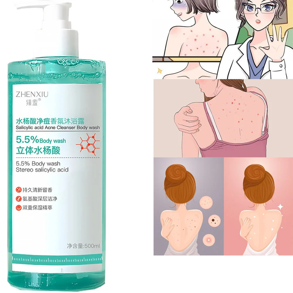 16.9 oz Salicylic Acid Body Wash, Gentle & Smoothing Mild Exfoliating Daily Acne Body Wash Deep Cleanses Back Acne and Sebum