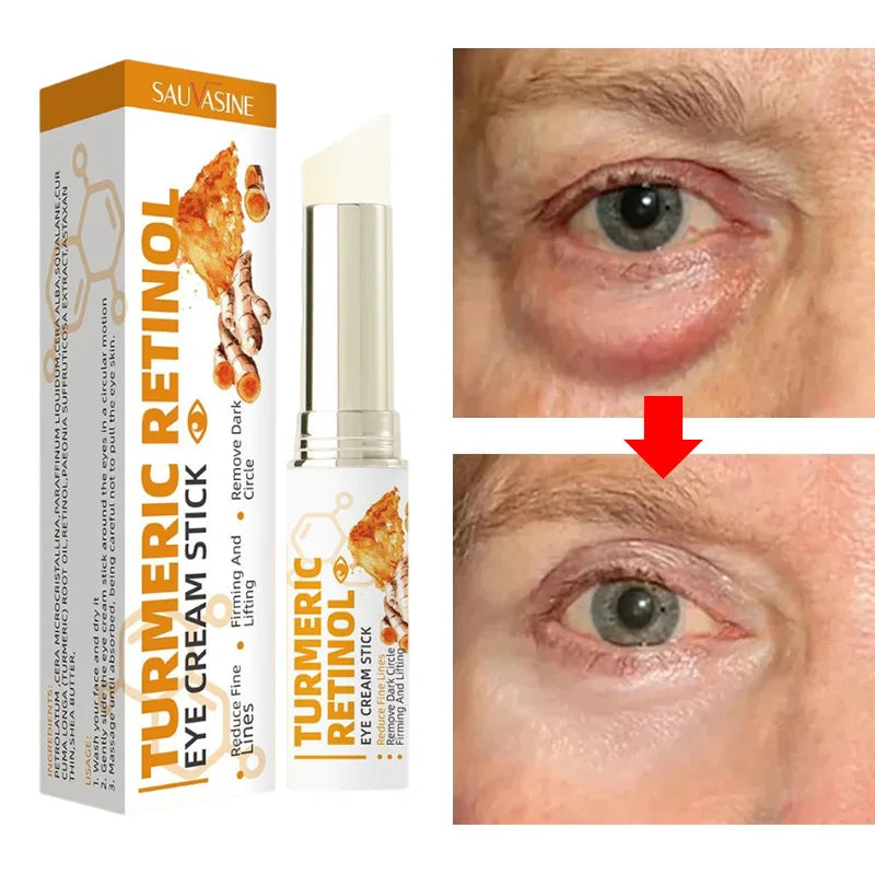 Instant Eye Bag Remove Eye Cream Anti Fat Particles Dark Circles Puffiness Fade Fine Lines Lift Brighten Korean Beauty Eye Care