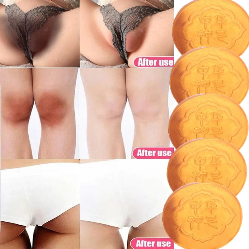 Body Whitening Soap Deep Clean Skin Chicken Skin Removal Soap Armpit Underarm Knees Bleaching Body Brighten White Care Products