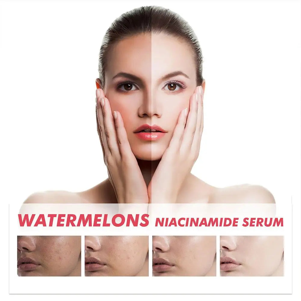 Watermelon Glow Niacinamide Moisturize Serum,Moisturizing Facial Serum W/ Hyaluronic Acid Vitamin E,Hydrating Brighten Skincare