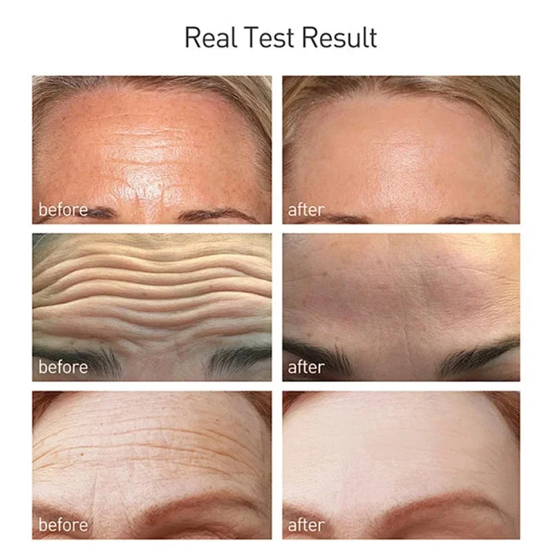 Rice Raw Pulp Serum Hyaluronic Acid Face Essence Nourishing Moisturizing Whitening Anti-Wrinkle Brighten Smooth Facial Skin Care