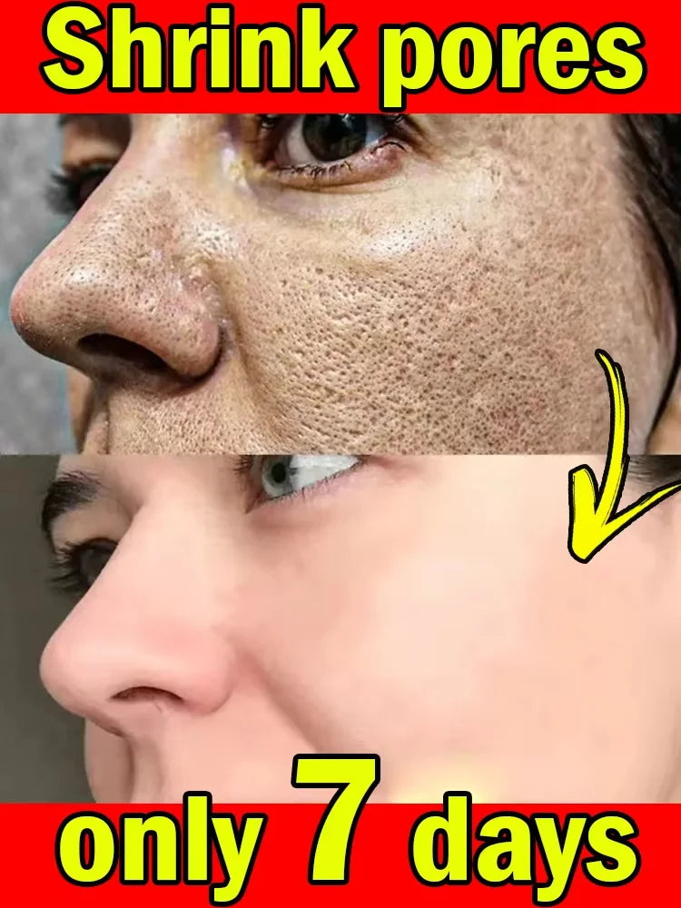 Bubble Face Cleaning Mask Blackhead Remove Pore Shrink Controlling Oil Moisturizing Whitening Brighten Skin Tone Fade Acne Scars