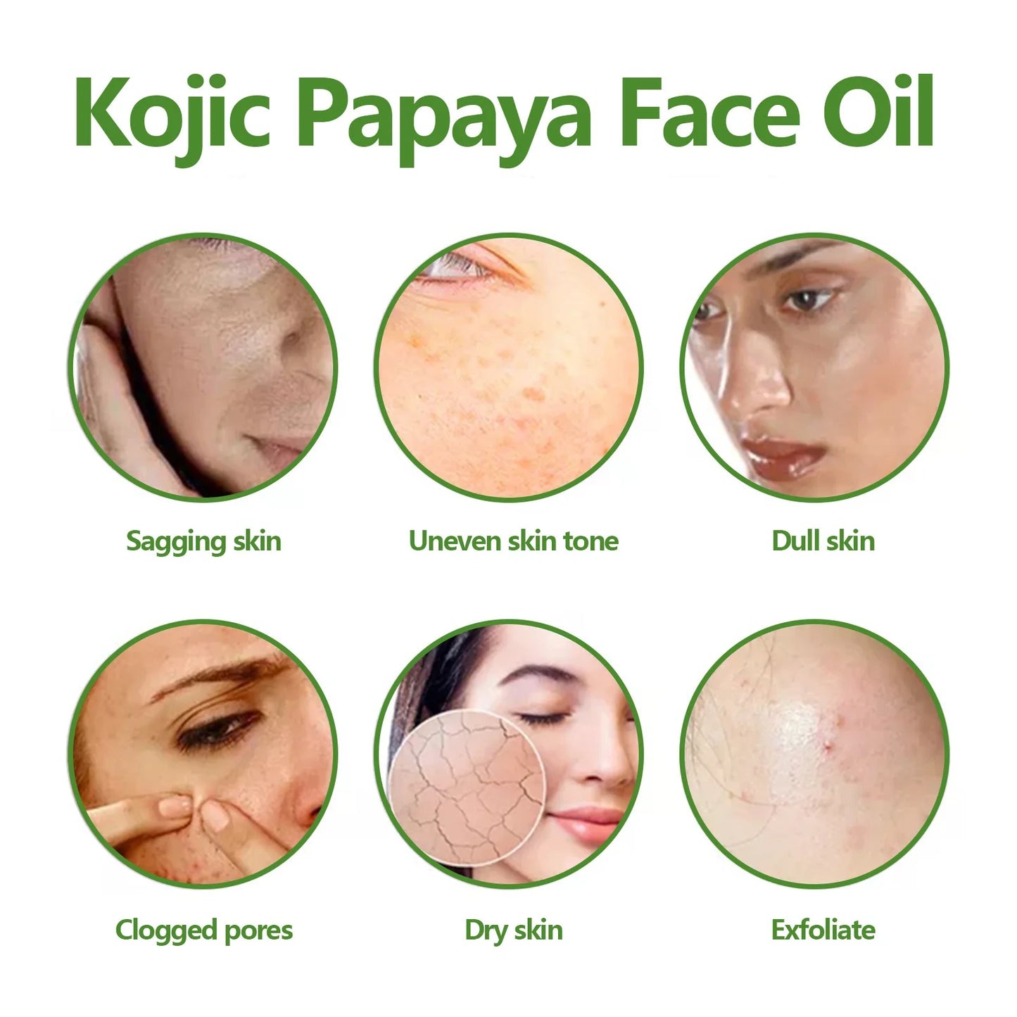 Dark Spots Remover Whitening Freckles Remove Acne Melasma Fade Melanin Pigmentation Shrink Pores Brightening Acne Treatment Oil