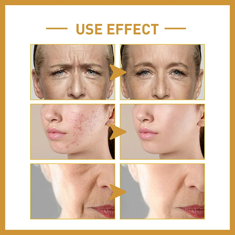 Rice Raw Pulp Serum Hyaluronic Acid Face Essence Nourishing Moisturizing Whitening Anti-Wrinkle Brighten Smooth Facial Skin Care