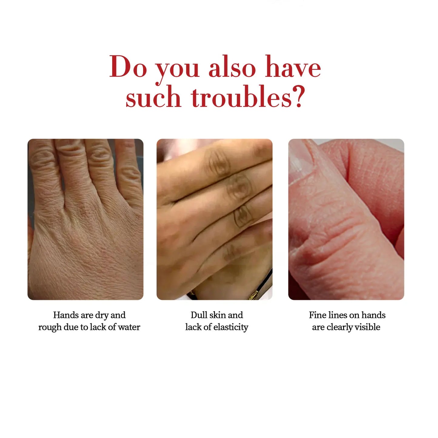 Kojic Acid Hand Cream Whitening Fast Smooth Nourish Cream Lightening Dark Skin Brightening Moisturizing Skin Care for Men Women