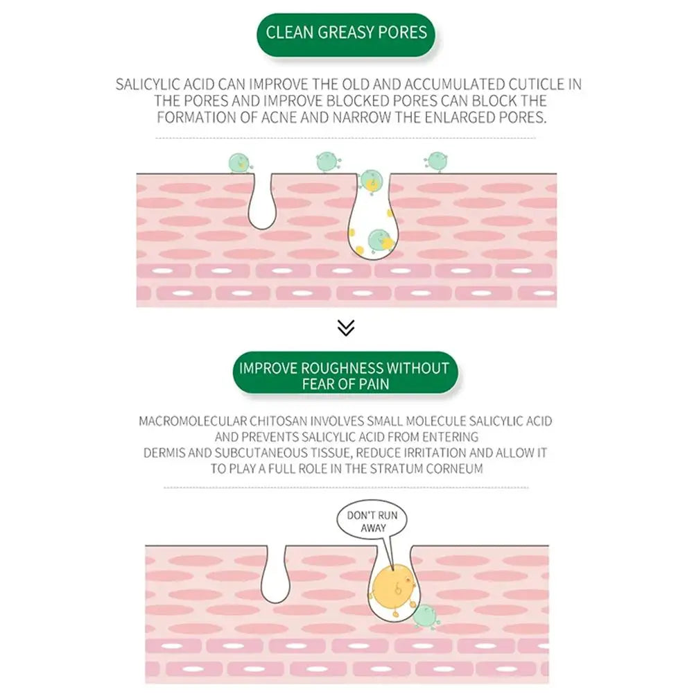 Salicylic Acid Pore Shrinking Essence Anti-acne Exfoliating Blackhead Remover Face Spot Removal Essence Beauty Health Skin Care