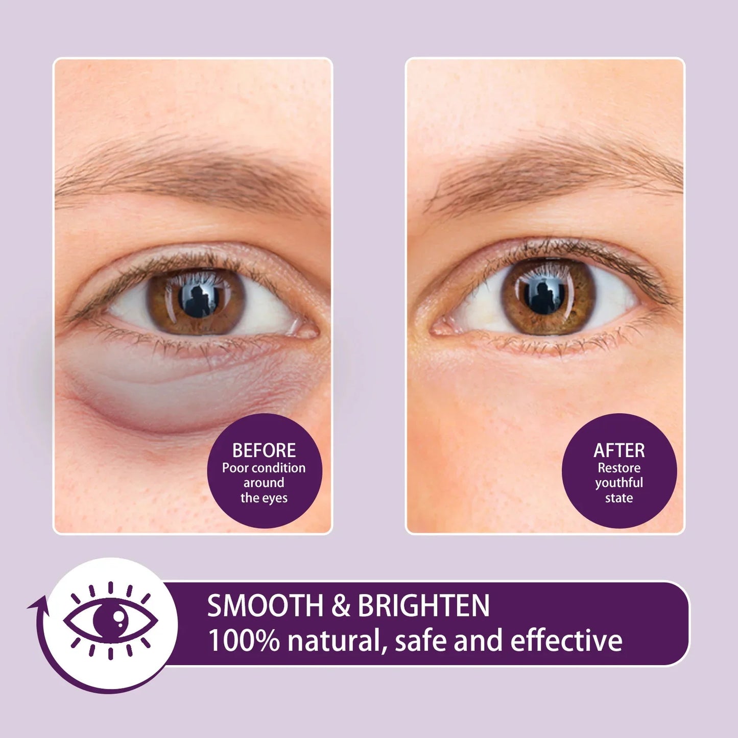Instant Eye Bag Remove Eye Cream Anti Fat Particles Dark Circles Puffiness Fade Fine Lines Lift Brighten Korean Beauty Eye Care