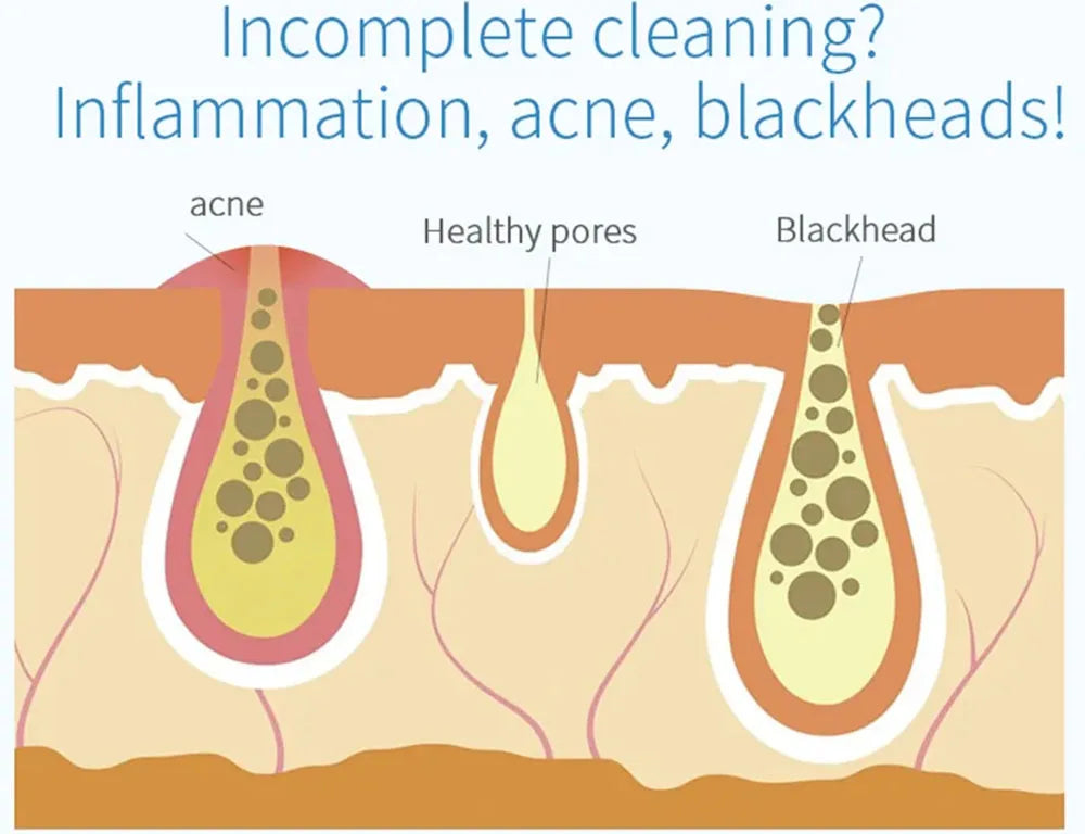 2IN1 Vacuum Acne Pore Cleaner Small Bubble Blackhead Remover Skin Deep Cleaning Beauty Care Tools Moisturizing Beauty Instrument