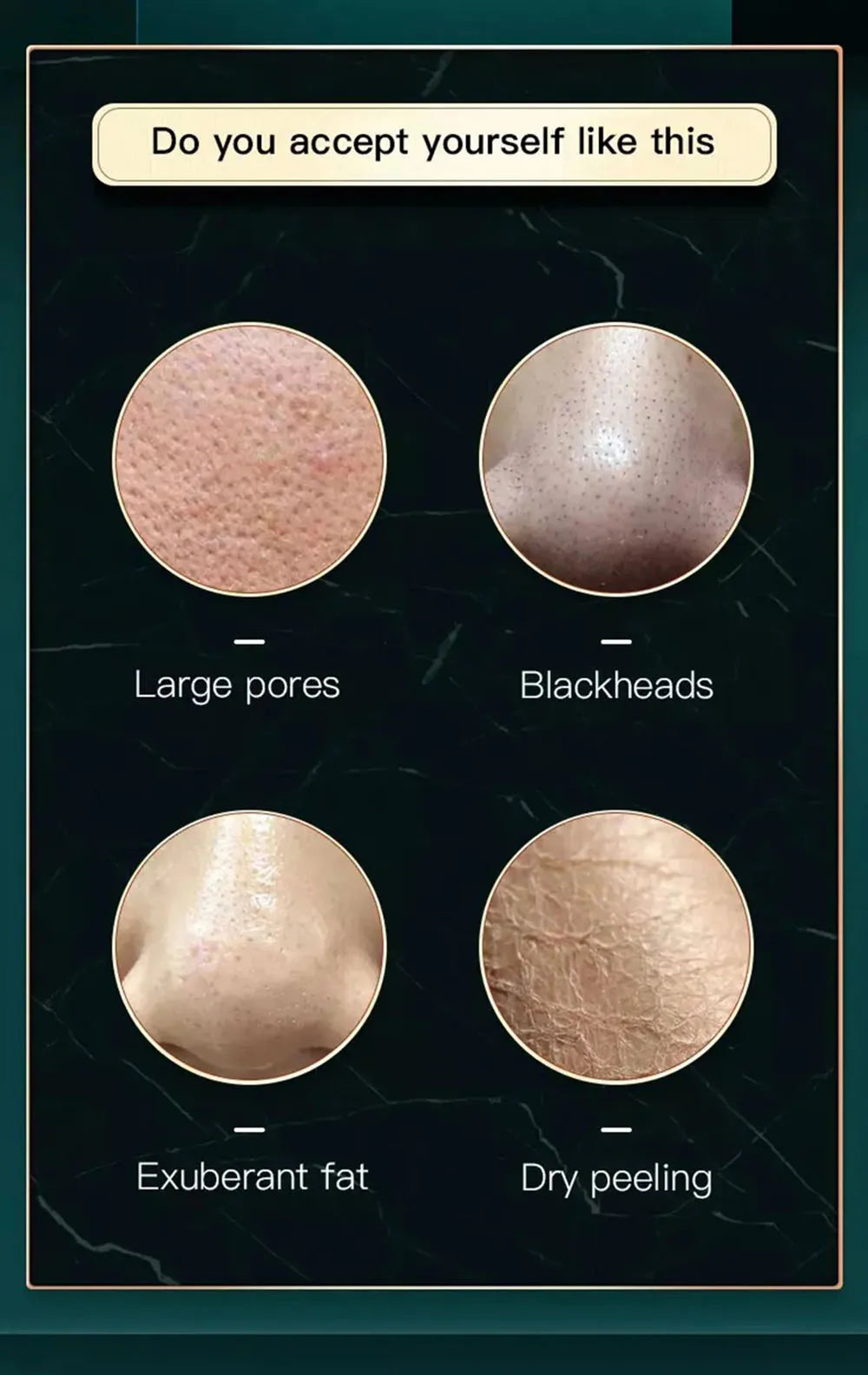 2IN1 Vacuum Acne Pore Cleaner Small Bubble Blackhead Remover Skin Deep Cleaning Beauty Care Tools Moisturizing Beauty Instrument