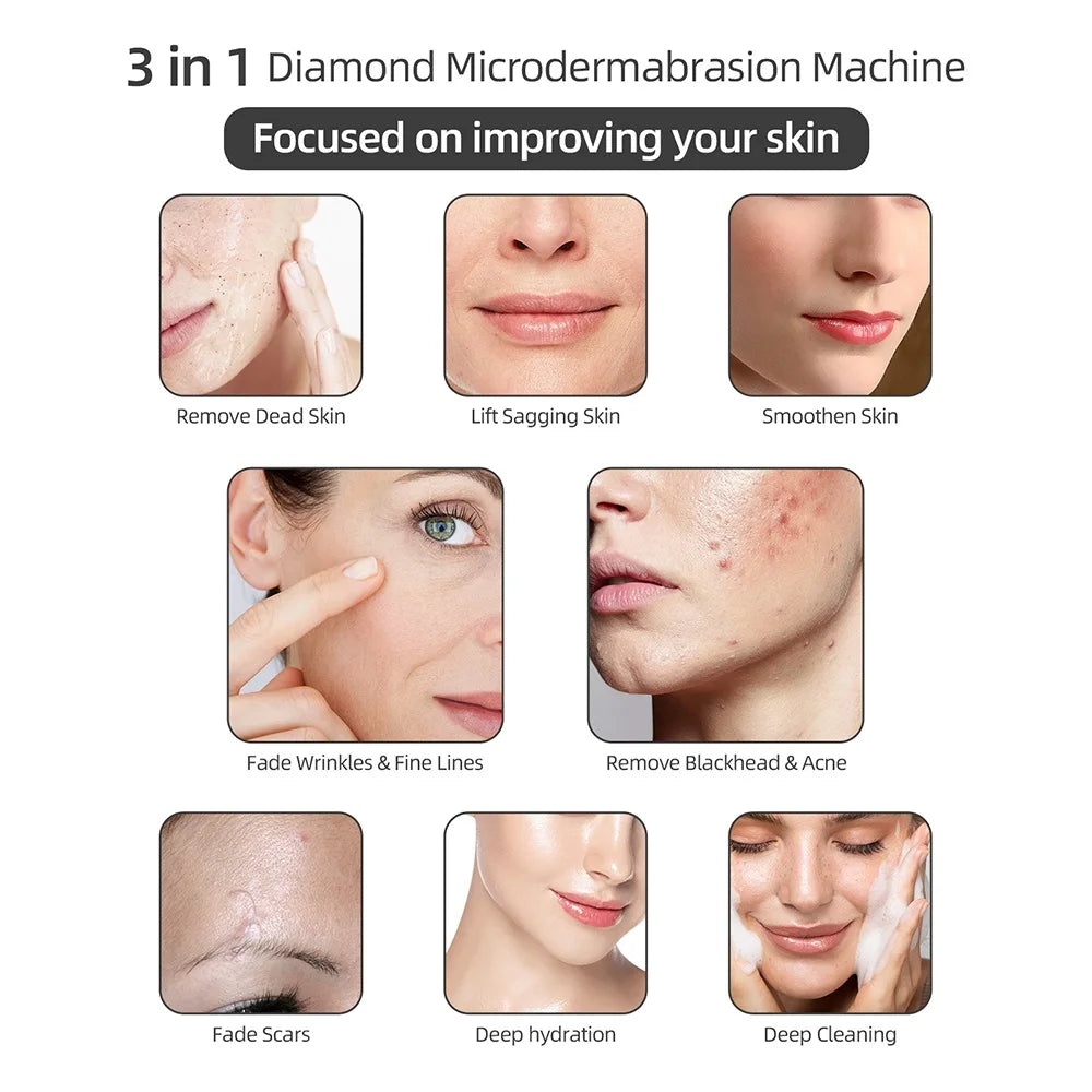 Diamond Microdermabrasion Machine For Facial Peeling Skin Care Blackhead Removel Water Spray Exfoliation Machine