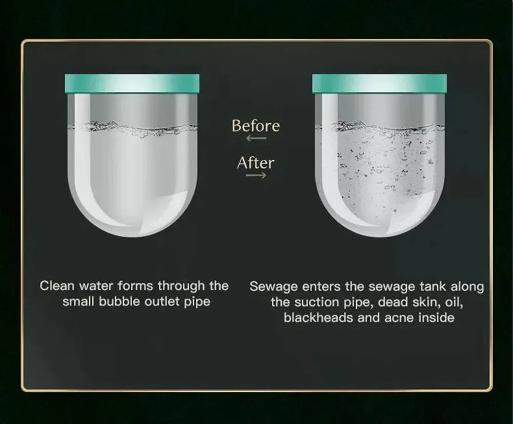 2IN1 Vacuum Acne Pore Cleaner Small Bubble Blackhead Remover Skin Deep Cleaning Beauty Care Tools Moisturizing Beauty Instrument