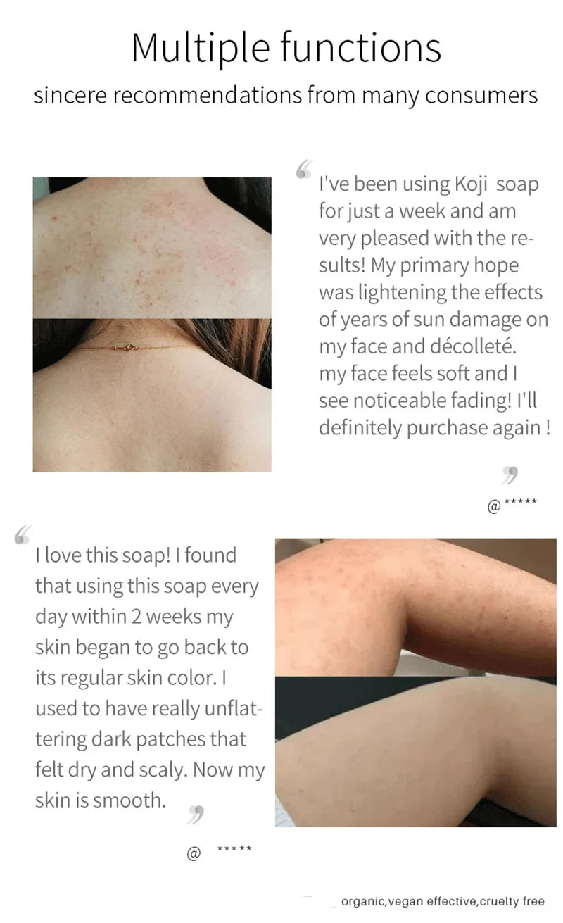 Body Whitening Soap Deep Clean Skin Chicken Skin Removal Soap Armpit Underarm Knees Bleaching Body Brighten White Care Products