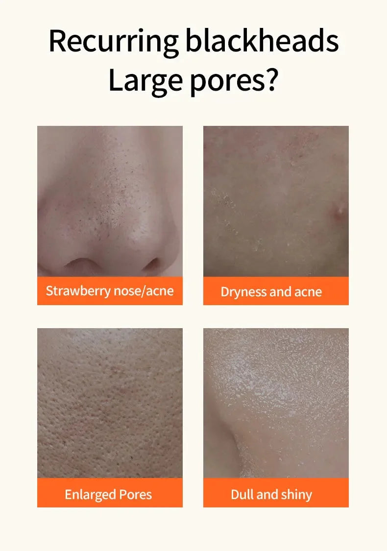 Bubble Face Cleaning Mask Blackhead Remove Pore Shrink Controlling Oil Moisturizing Whitening Brighten Skin Tone Fade Acne Scars