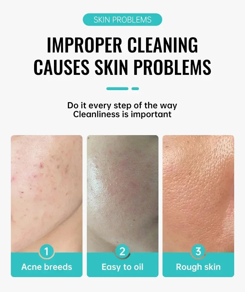 Salicylic Acid Acne Removal Cream Repair Pimple Spots Deep Cleaning Pore Shrinking Oil Control Whitening Moisturizing Skin Care