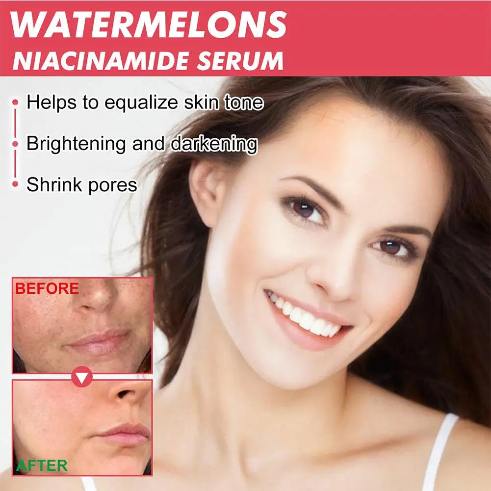 Watermelon Glow Niacinamide Moisturize Serum,Moisturizing Facial Serum W/ Hyaluronic Acid Vitamin E,Hydrating Brighten Skincare