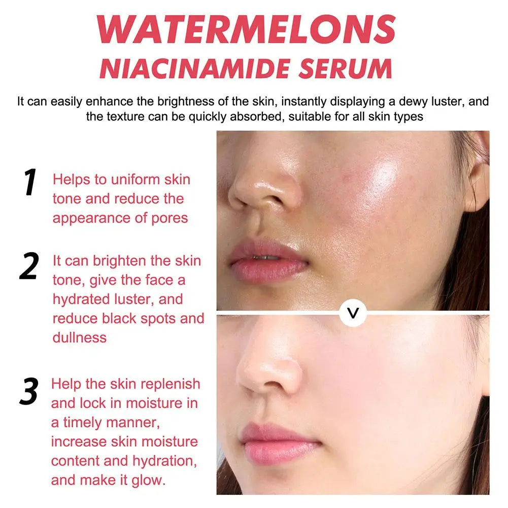 Watermelon Glow Niacinamide Moisturize Serum,Moisturizing Facial Serum W/ Hyaluronic Acid Vitamin E,Hydrating Brighten Skincare