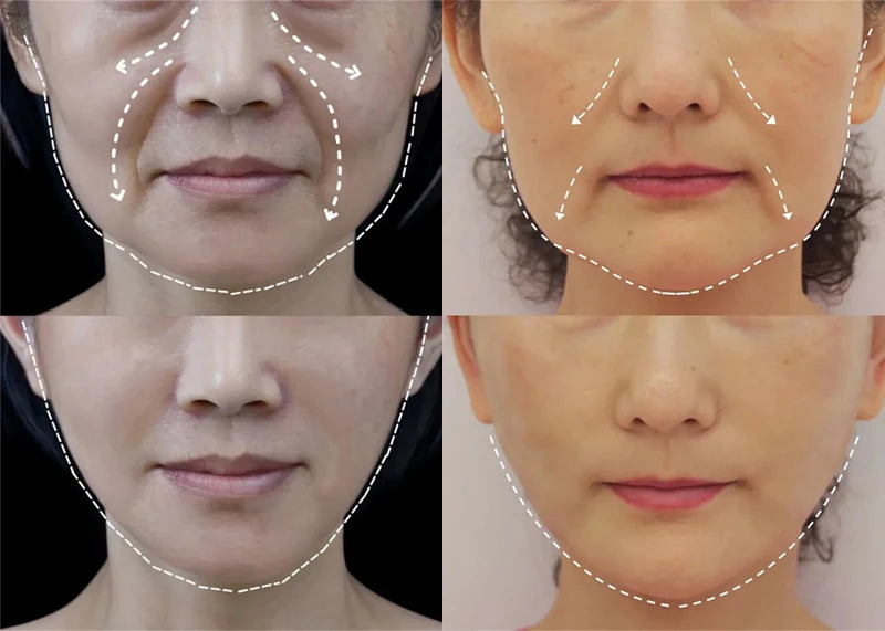 Rice Raw Pulp Serum Hyaluronic Acid Face Essence Nourishing Moisturizing Whitening Anti-Wrinkle Brighten Smooth Facial Skin Care